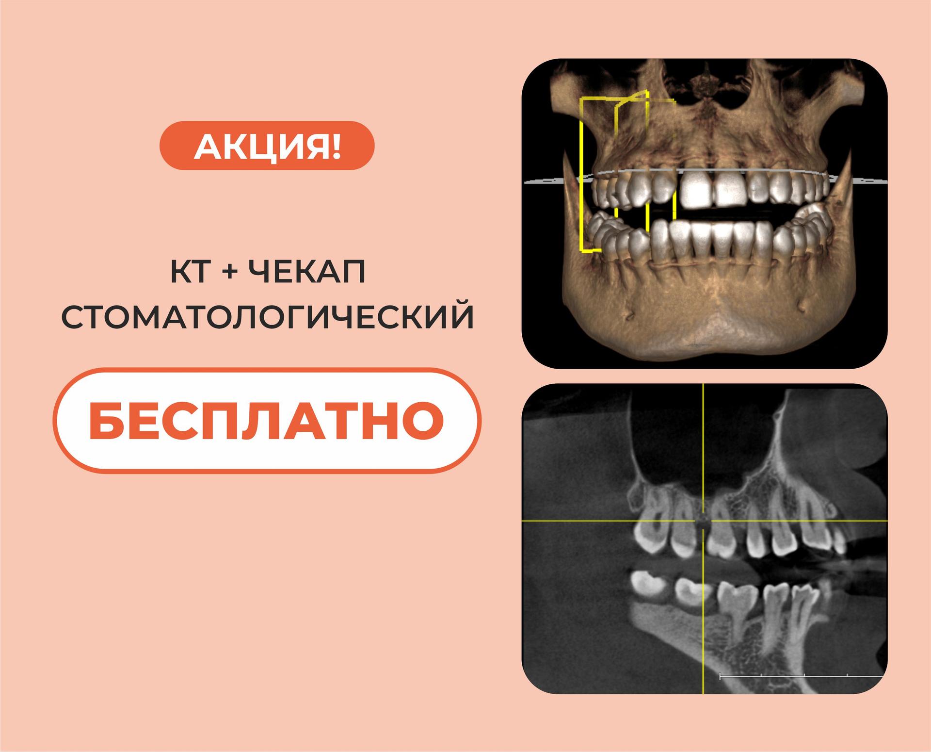 «УЛЫБКА»