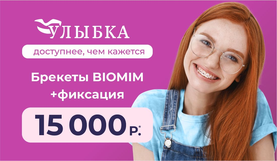 Брекеты за 15 000 ₽ на одну челюсть