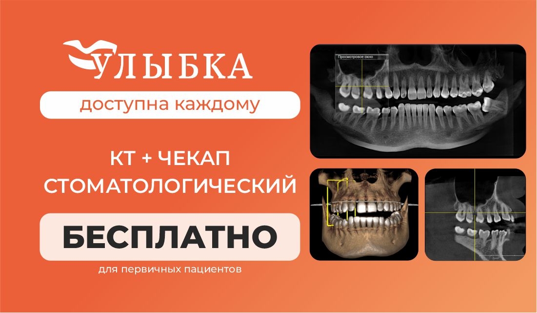 КТ + стоматологический чекап бесплатно