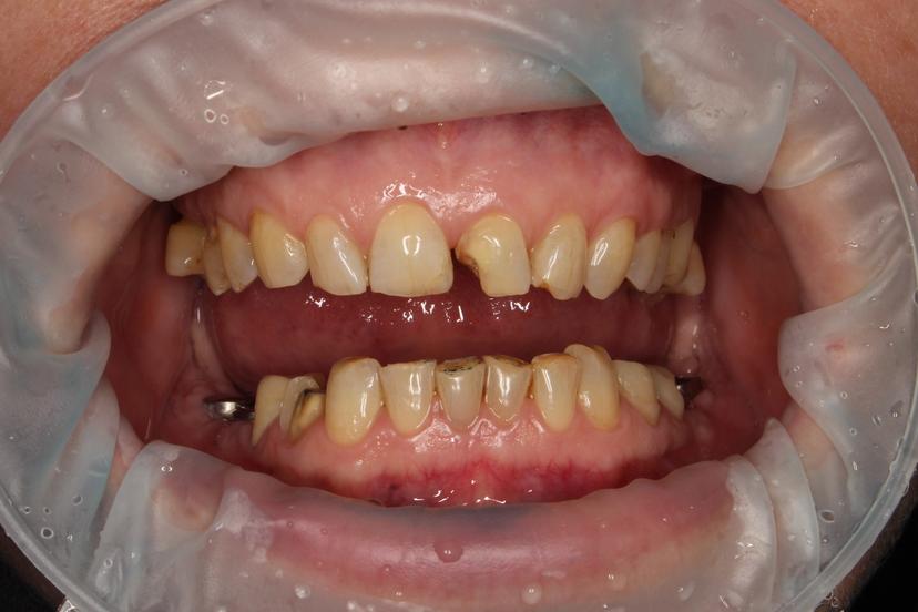 Фото до